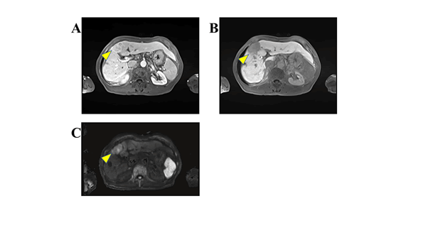 Research Journal of Oncology-CT